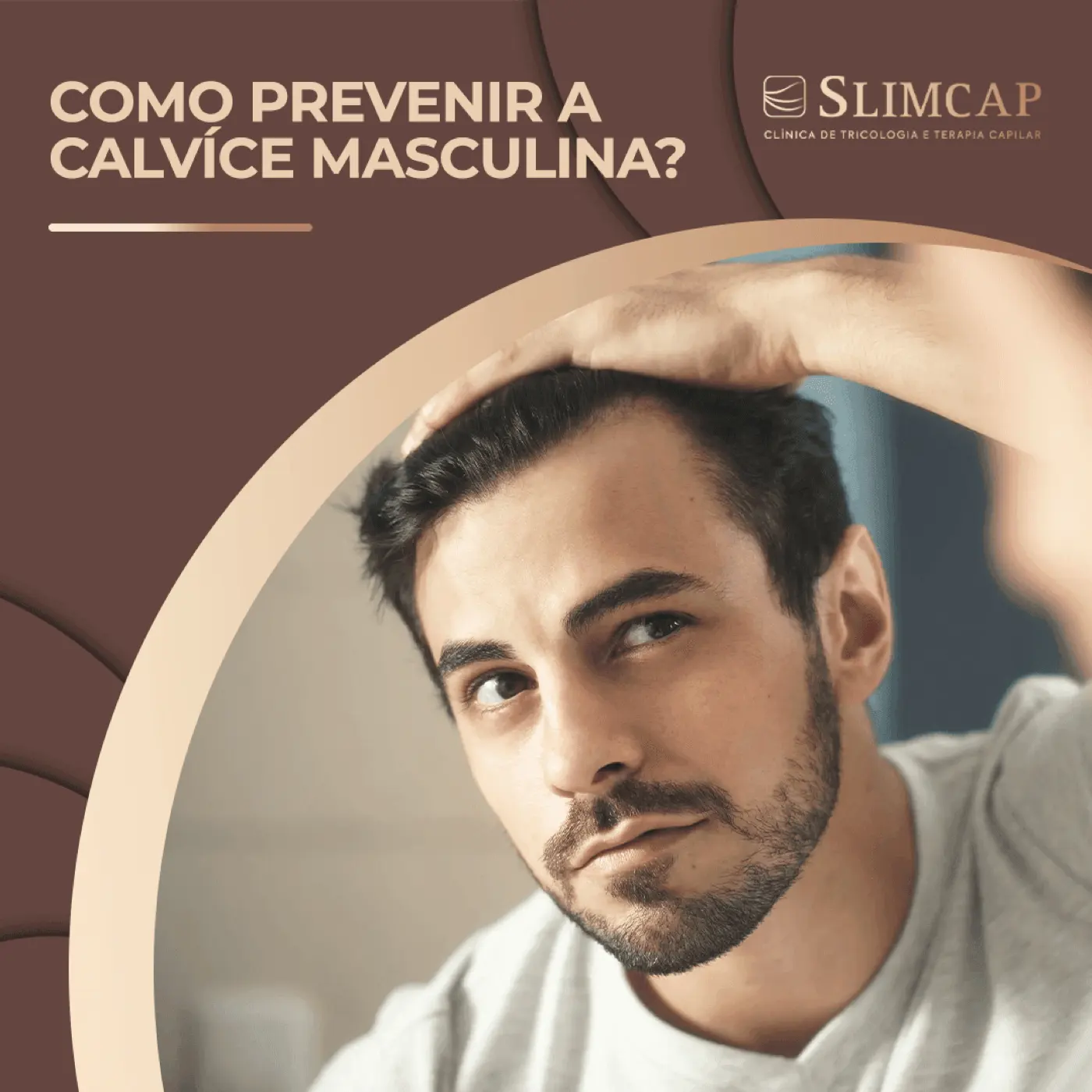 Como prevenir a calvície masculina?